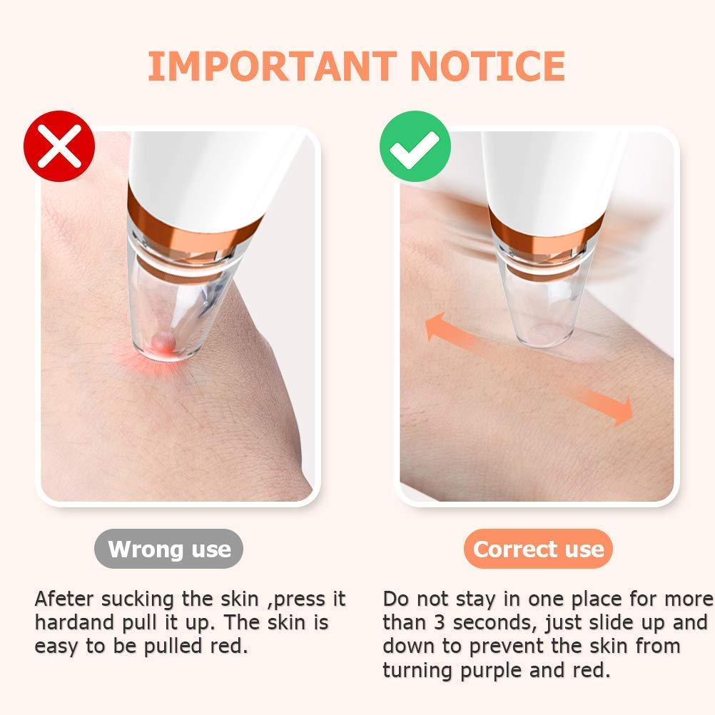 Vacuum Suction Blackhead