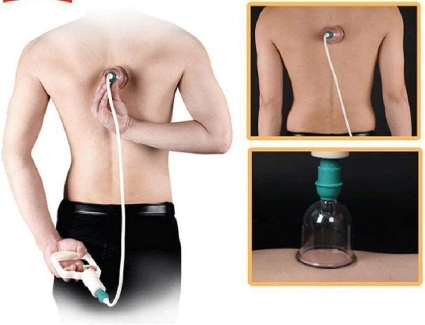 Cupping Therapy Set